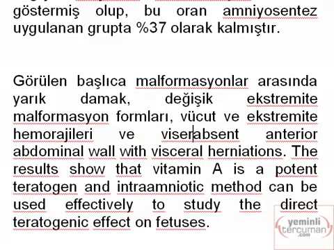 İngilizce paragraf örnekleri