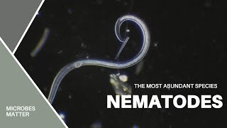 Nematodes - the most abundant multicellular species - under the microscope.