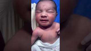 Moro Reflex newborn baby #nicu #premature #cutebaby #newborn #medical #hospital #neonataltherapy