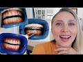 IS IT WORTH IT? Professional teeth whitening! BEFORE & AFTER! | THE BLONDE AVENUE