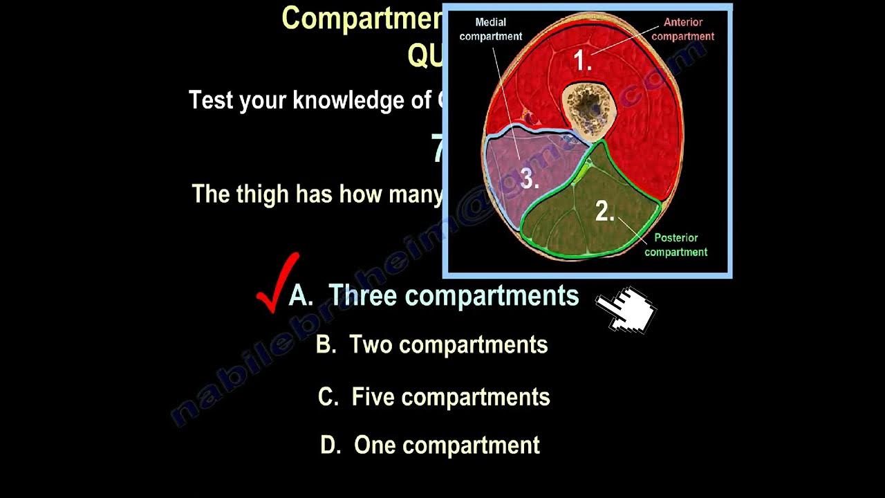 Compartment Syndrome ,test your knowledge YouTube