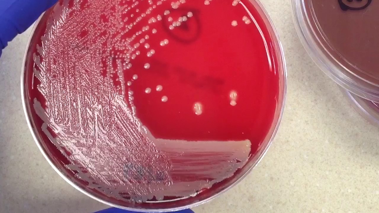 Plate Reading Wound I YouTube Plate Reading Wound I YouTube