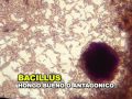TRAMPA PARA MICROORGANISMOS y ANALISIS DE SUELOS