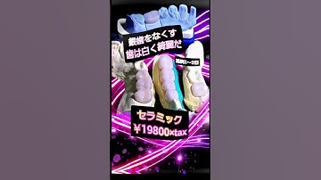 Thumbnail of 【銀歯ヤバい】好きな人に銀歯みられた