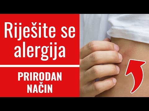 Kako izliječiti ALERGIJE na prirodan način? │ Simptomi koji ukazuju na INTOLERANCIJU NA HRANU