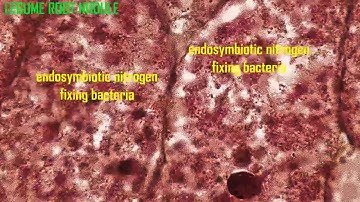 NITROGEN FIXING BACTERIA IN LEGUME ROOT NODULES