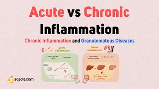 Chronic Inflammation and Granulomatous Diseases | Acute vs Chronic Inflammation | Immunology