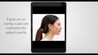 Match Patients Profile Image To The Ceph Tracing With Cephx Ai Algorithms