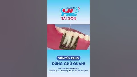 Viêm tủy răng đừng chủ quan