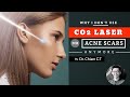 Why We Don’t Use CO2 Lasers For Acne Scars Anymore | Dr. Chiam CT