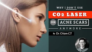 Why We Don’t Use CO2 Lasers For Acne Scars Anymore | Dr. Chiam CT screenshot 5
