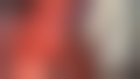 Right hepatic trisectionectomy after portal vein ligation