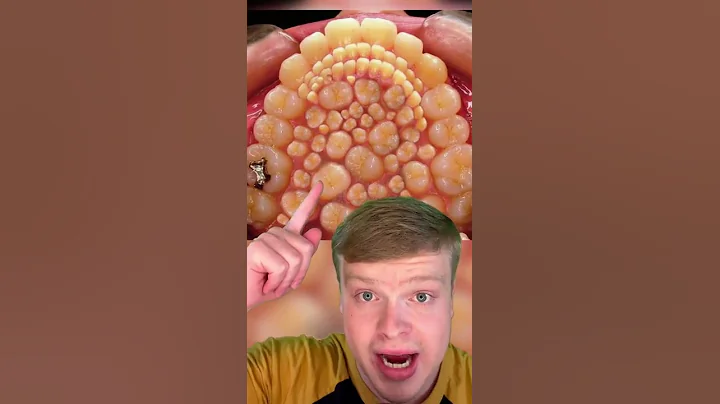 THIS BOY HAD OVER 232 TEETH REMOVED!!! 🦷😳 - DayDayNews