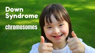 Down Syndrome Chromosomes | How Many?