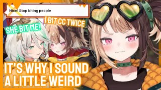 Download Lagu Gigi Admits She Bit Too Many People and Has to Fix Her Bite Issue MP3