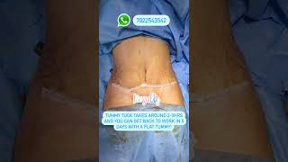 Tummy Tuck (Abdominoplasty) in Bangalore by Dr Sreekar Harinatha
