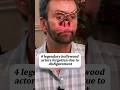 4 Legendary hollywood actor forgotten due disfigurement #celebrity #hollywood #actor #singer #music
