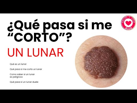 Video: ¿Cuántos lunares hay en la aspirina?