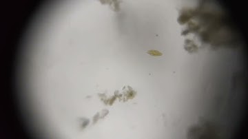 Sliding diatom seen using a foldscope