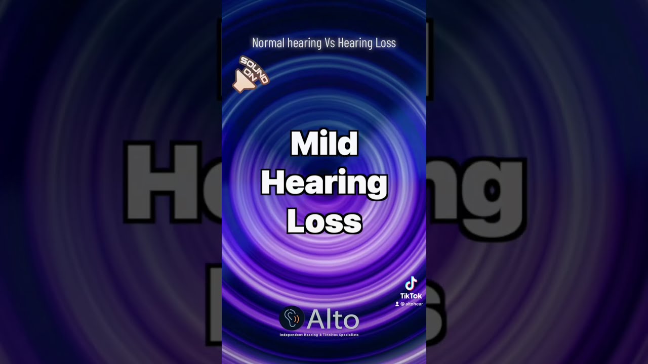 Normal Hearing Vs Loss Audiologist Audiology Hearinghealth Hearingloss