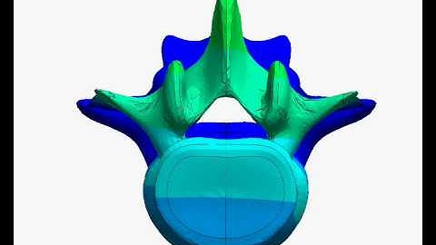 Lumbar Spine Finite Element Analysis (FEA) Model: L4-L5 Fully Coupled Motion & Load