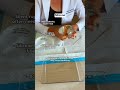Saline Or Silicone Implants Silicone Saline Saline Or Silicone Implants Silicone Saline