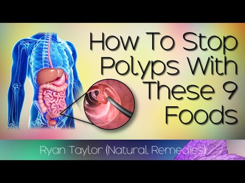 Foods That Prevent Polyps in the Colon