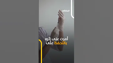 قبل أيام من موعد زفافها عروس مصرية تفارق الحياة بسبب حقنة تجميل 