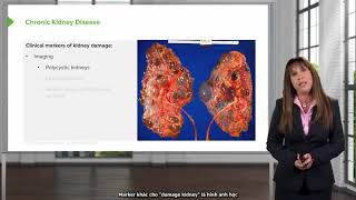 Chronic Kidney Disease Definition with Case – Nephrology  Lecturio (vietsub) - Case bệnh thận mạn