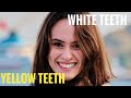 How To Whiten Teeth In Photoshop CC | Photoshop Teeth Whitening