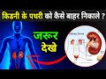 पथरी को बाहर निकालने का सबसे आसान तरीका | Kidney Stone Symptoms In Hindi
