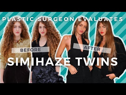 SimiHaze Twins Plastic Surgery Transformation