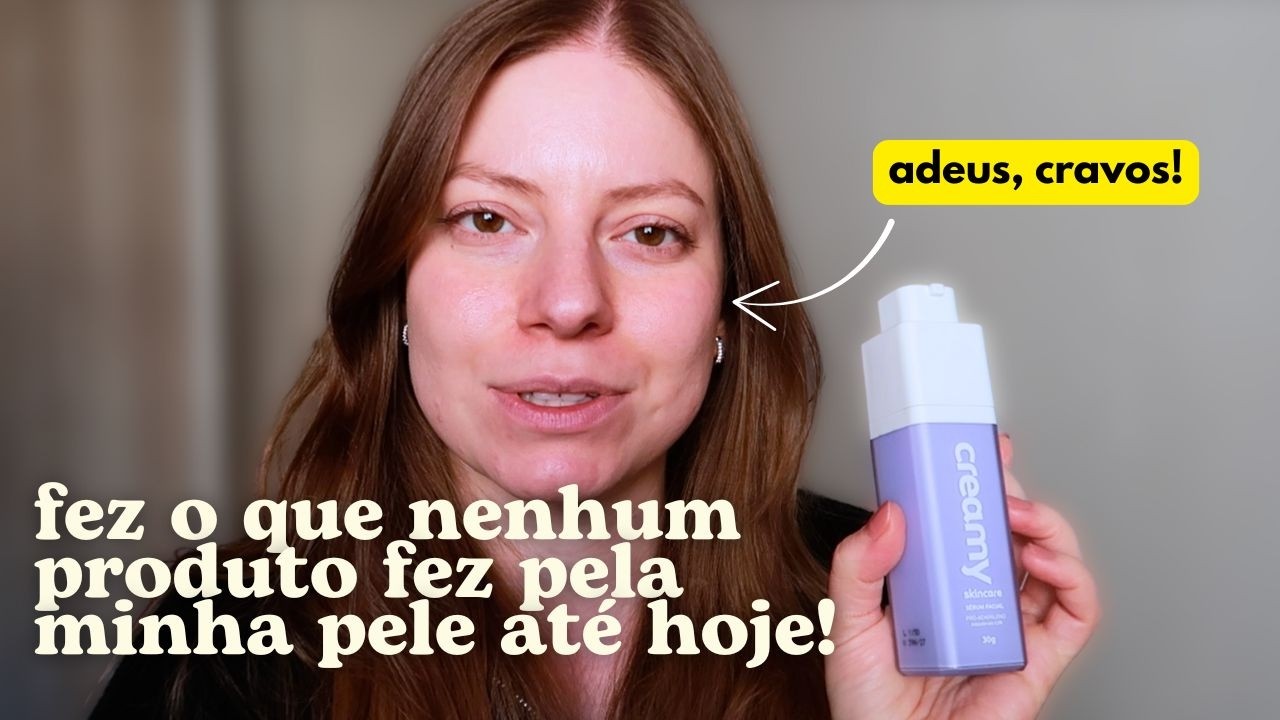 ADAPALENATO da Creamy: Resenha de 3 meses de uso + por que não uso somente Functional Care!