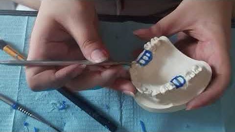 WAX PATTERN (CLASS 3 MODIFICATION 1)