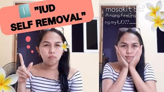 Iud Self Removal/Masakit Ba?/Iud Experience/Intrauterine Device