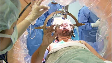 Qual o valor de uma cirurgia de Parkinson?