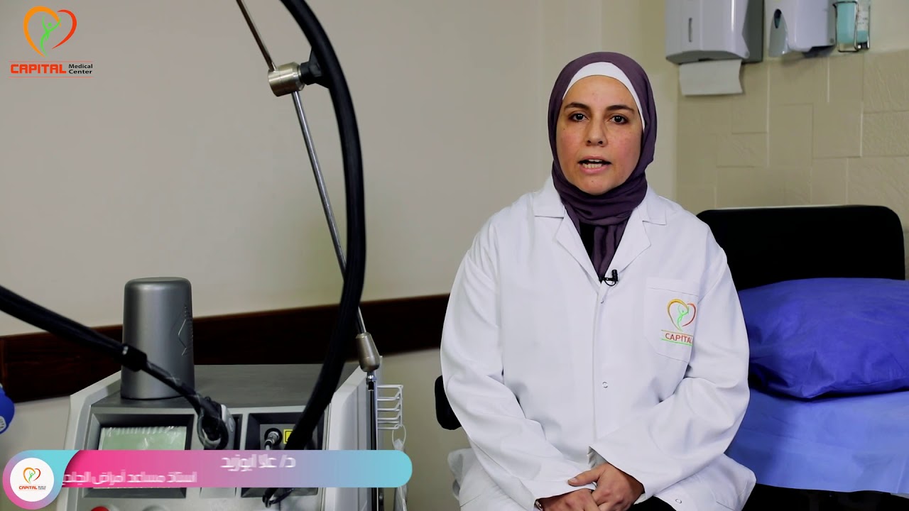 تمدد الشعيرات الدموية السطحية وطرق علاجها بالليزر  مع  د  علا ابوزيد