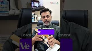 Suffering from knee pain? Don't Ignore It – Know Your Options!