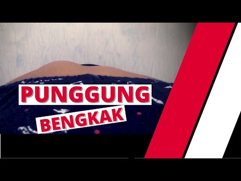 Kumpulan video pembengkakan di punggung