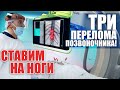 ДЕНЬ ИЗ ЖИЗНИ НЕЙРОХИРУРГА | Перелом позвоночника, как лечить?