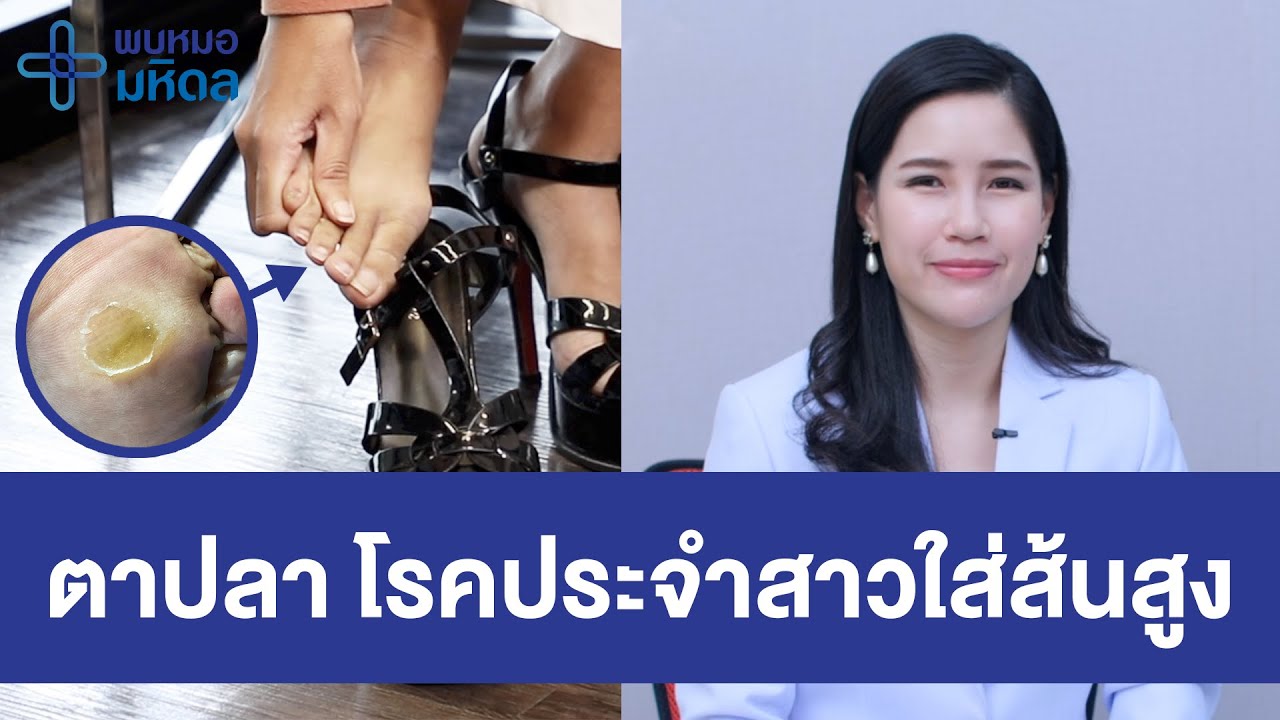 ตาปลา โรคประจำสาวใส่ส้นสูง | พบหมอมหิดล [by Mahidol Channel]