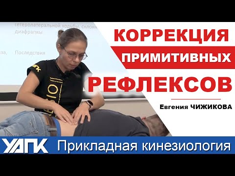 Диагностика и коррекция примитивных рефлексов  (Е.Чижикова)