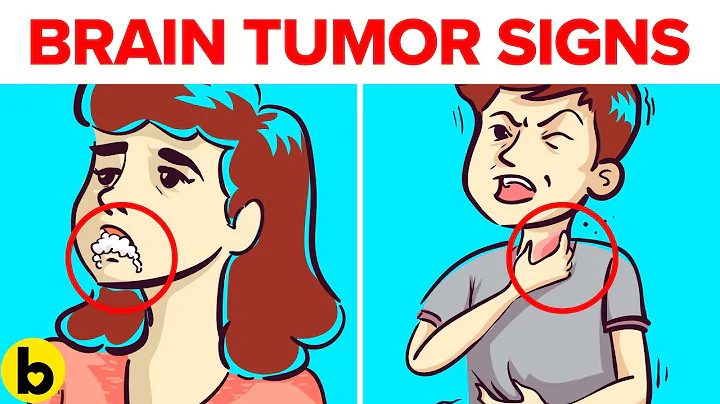 10 SUBTLE Warning Signs You Have A BRAIN TUMOR - Are You At RISK? - DayDayNews