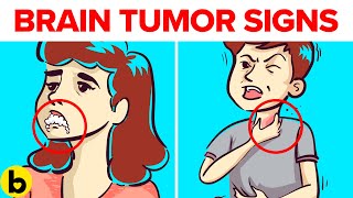10 SUBTLE Warning Signs You Have A BRAIN TUMOR - Are You At RISK?