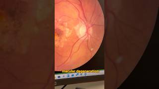 Why an OCT scan is essential for your eye health!