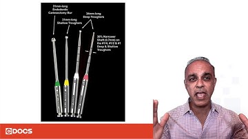 Tip of the Day: Troughing