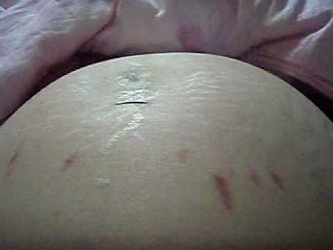 第二胎胎動-