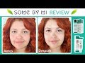 REVIEW DE PRODUCTOS DE BELLEZA COREANOS - SOME BY MI (mi opinión honesta) | Mirem Itziar ❤