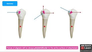 All you need to know about aligners & attachments biomechanics (part 1)