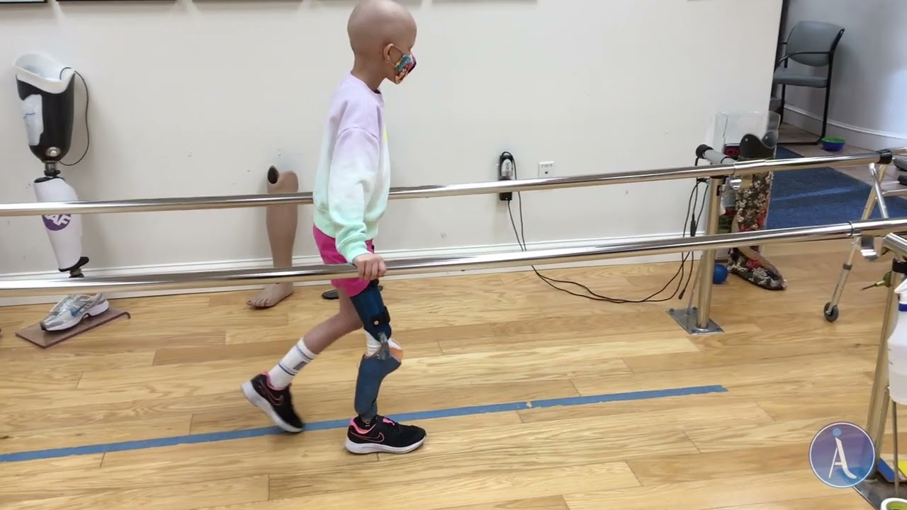 Rotationplasty Video Rotationplasty | Boston Children's Hospital